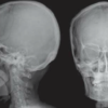 radiografia craniana.